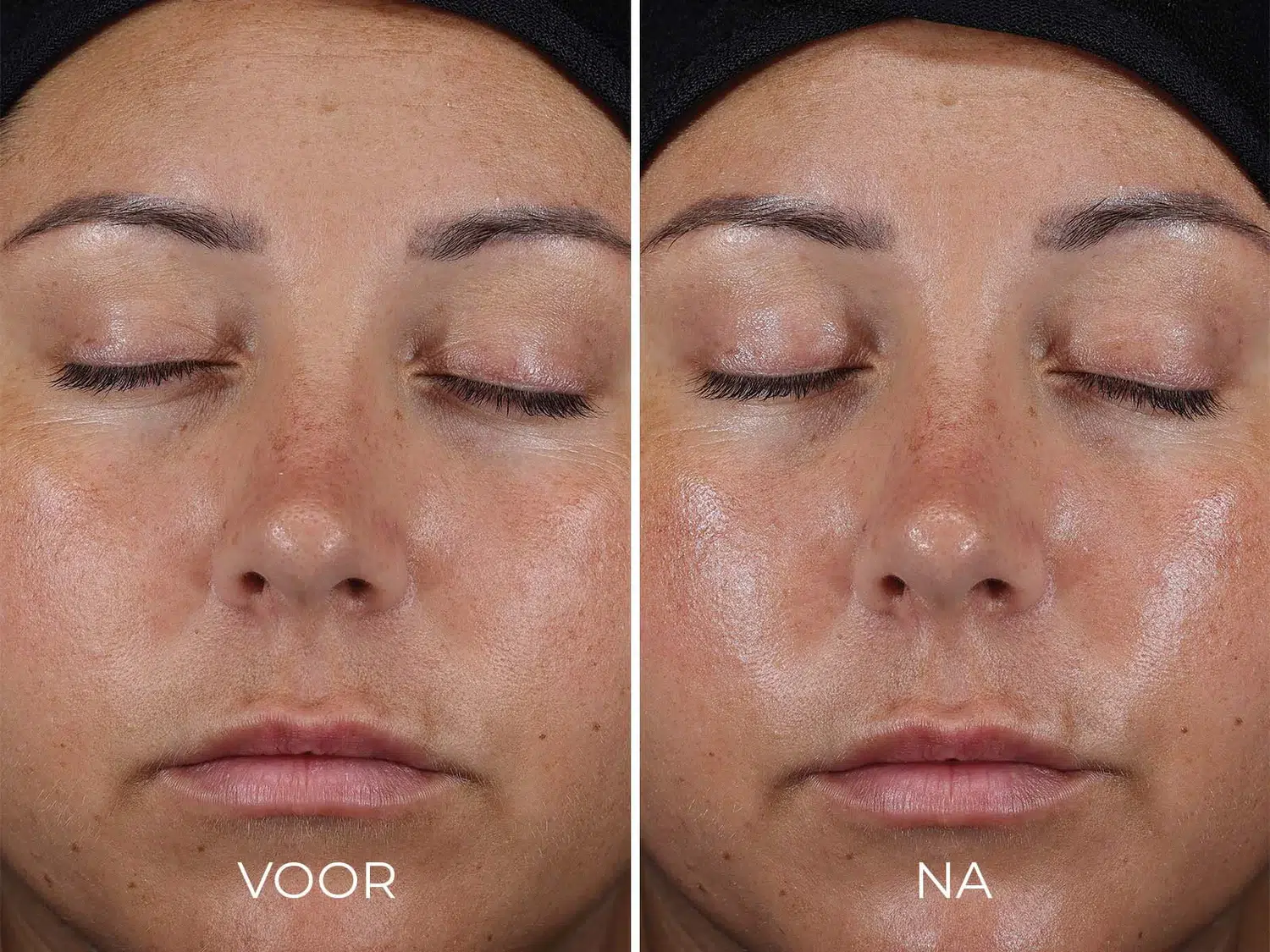DAILY PREVENTION - Ultra Defense Moisturizer SPF 50 - Afbeelding 4