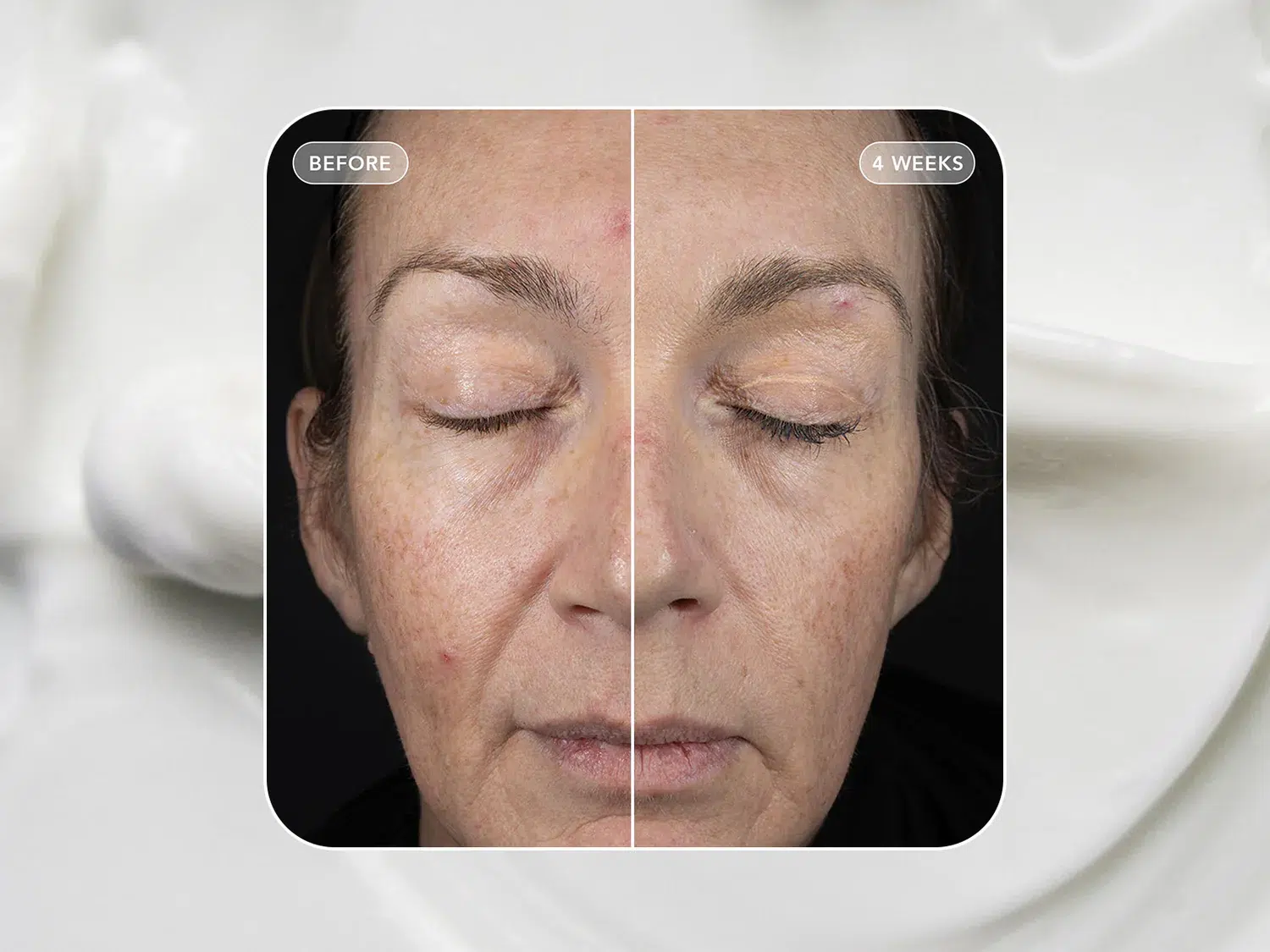 VOL.U.LIFT - 4D Skin Rebound Complex - Afbeelding 3