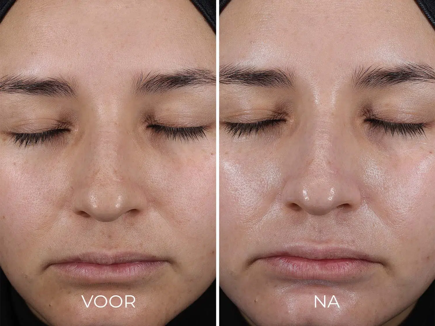 DAILY PREVENTION - Pure Mineral Hydrating Moisturizer SPF 30 - Afbeelding 4